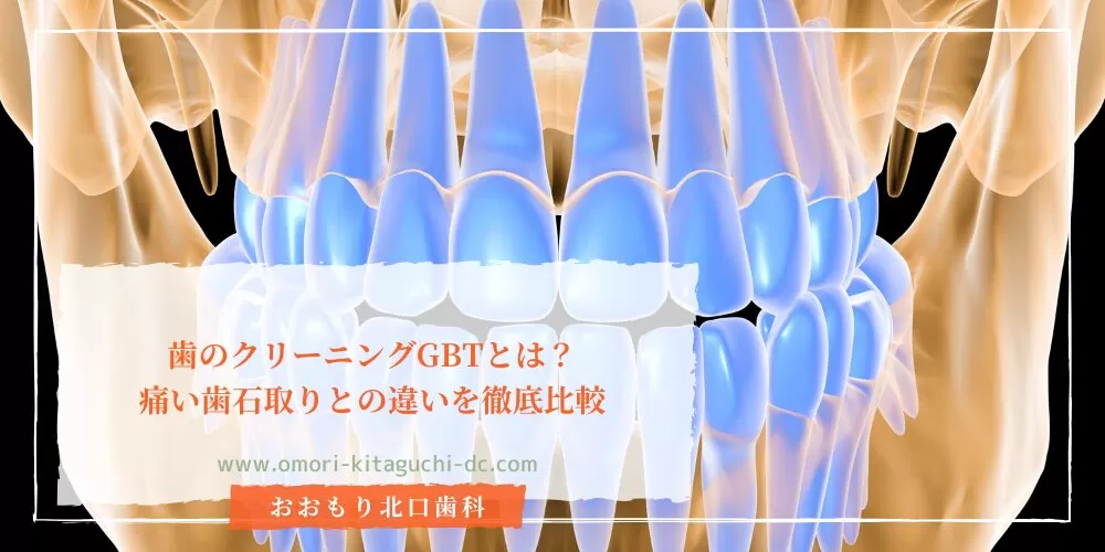 歯のクリーニングGBTとは？痛い歯石取りとの違いを徹底比較