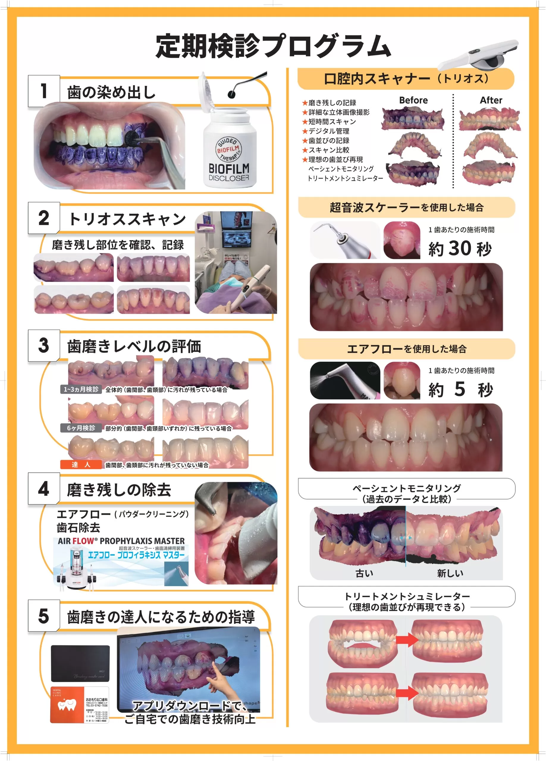 定期検診プログラム