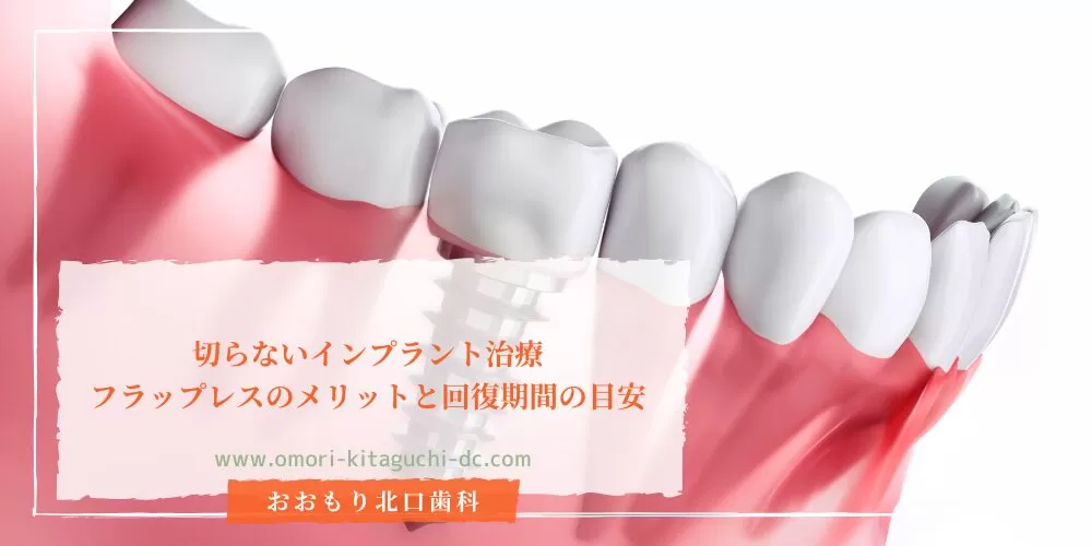 切らないインプラント治療|フラップレスのメリットと回復期間の目安