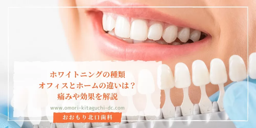 ホワイトニングの種類|オフィスとホームの違いは?痛みや効果を解説
