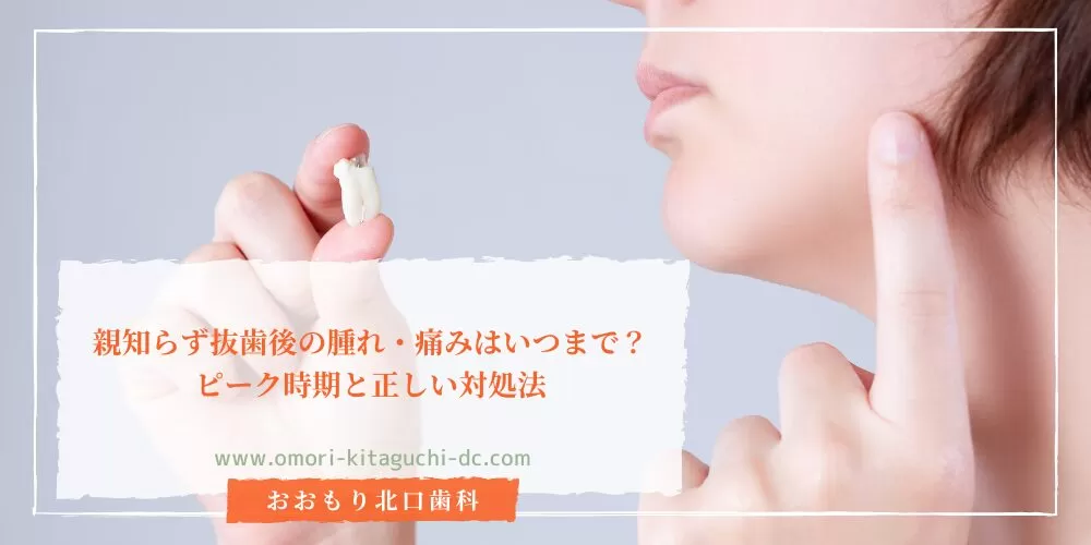 親知らず抜歯後の腫れ・痛みはいつまで?ピーク時期と正しい対処法
