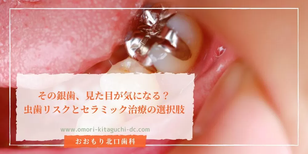 その銀歯、見た目が気になる?虫歯リスクとセラミック治療の選択肢
